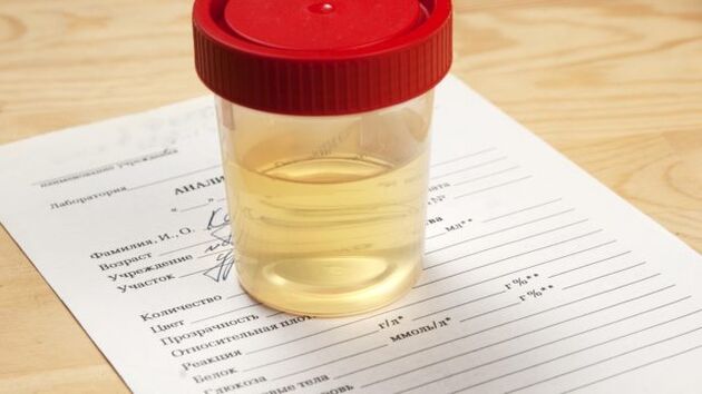 Analyse de l'urine pour l'hypertension artérielle